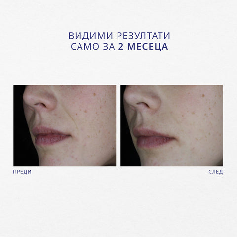 Hydraperfector Pleťové Sérum